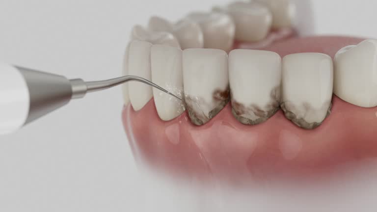 Reliable Emergency Dentist contractor in North Lima, OH by Smile Center Dentistry